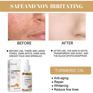 Foto 4 | Sérum Corrector De Manchas Oscuras Con Cúrcuma 30 Ml Alto Brillo Para El Cuidado De La Piel - Venta Internacional.
