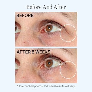 Foto 3 | Bálsamo Hidratante Para Ojos Strivectin Contour Restore Firming - Venta Internacional.
