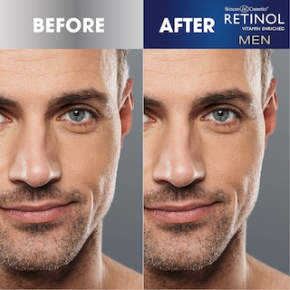 Foto 5 | Crema Para Ojos Con Retinol, Tratamiento Original Para Hombres, Reduce La Hinchazón - Venta Internacional.