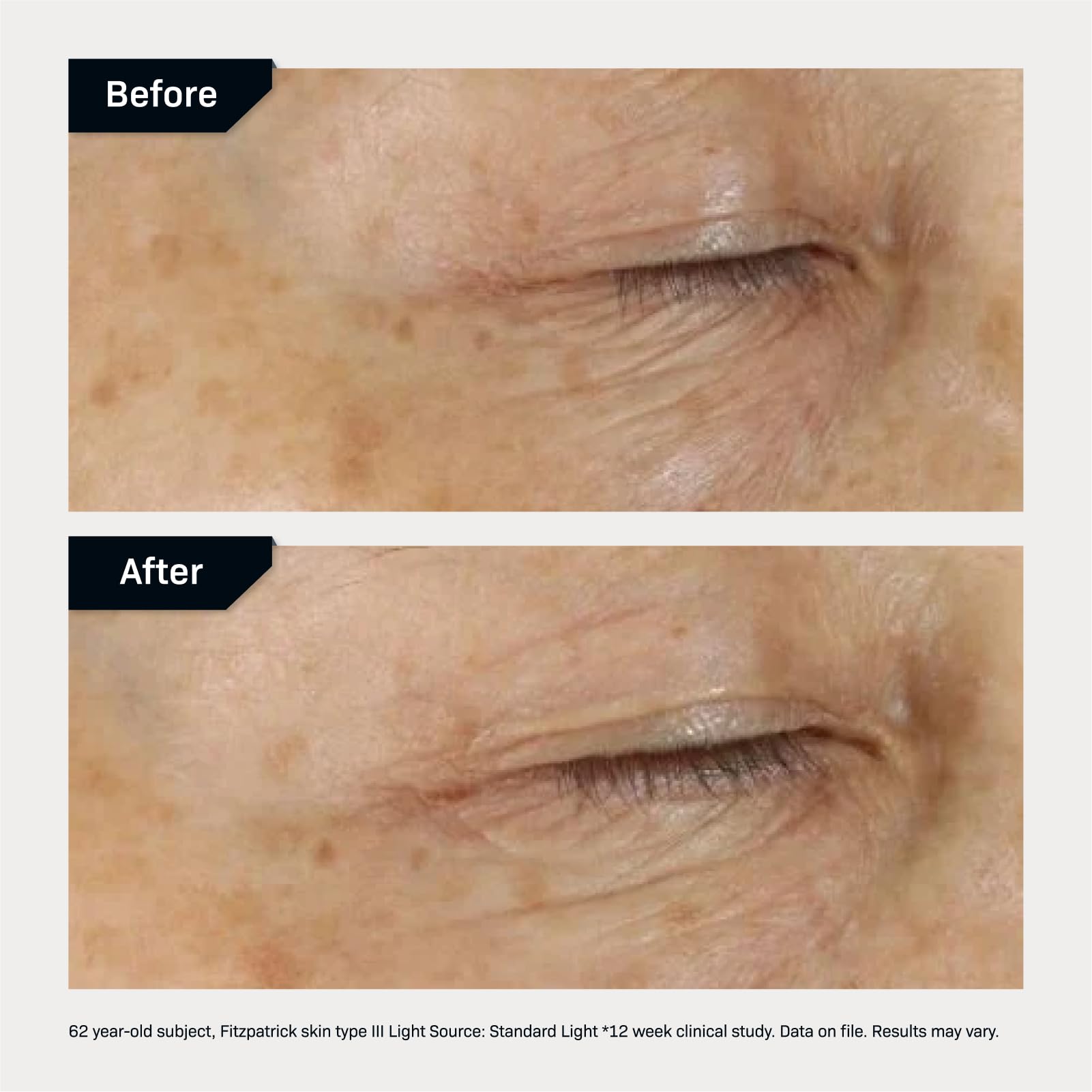 Foto 6 pulgar | Crema Para Ojos Revision Skincare D·e·j Hidratante Reafirmante, 7 Ml - Venta Internacional.
