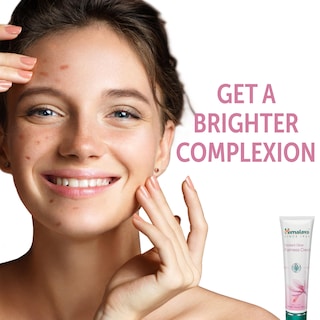 Foto 4 | Crema Himalaya Radiant Glow Fairness 100 G Para Manchas Oscuras - Venta Internacional.