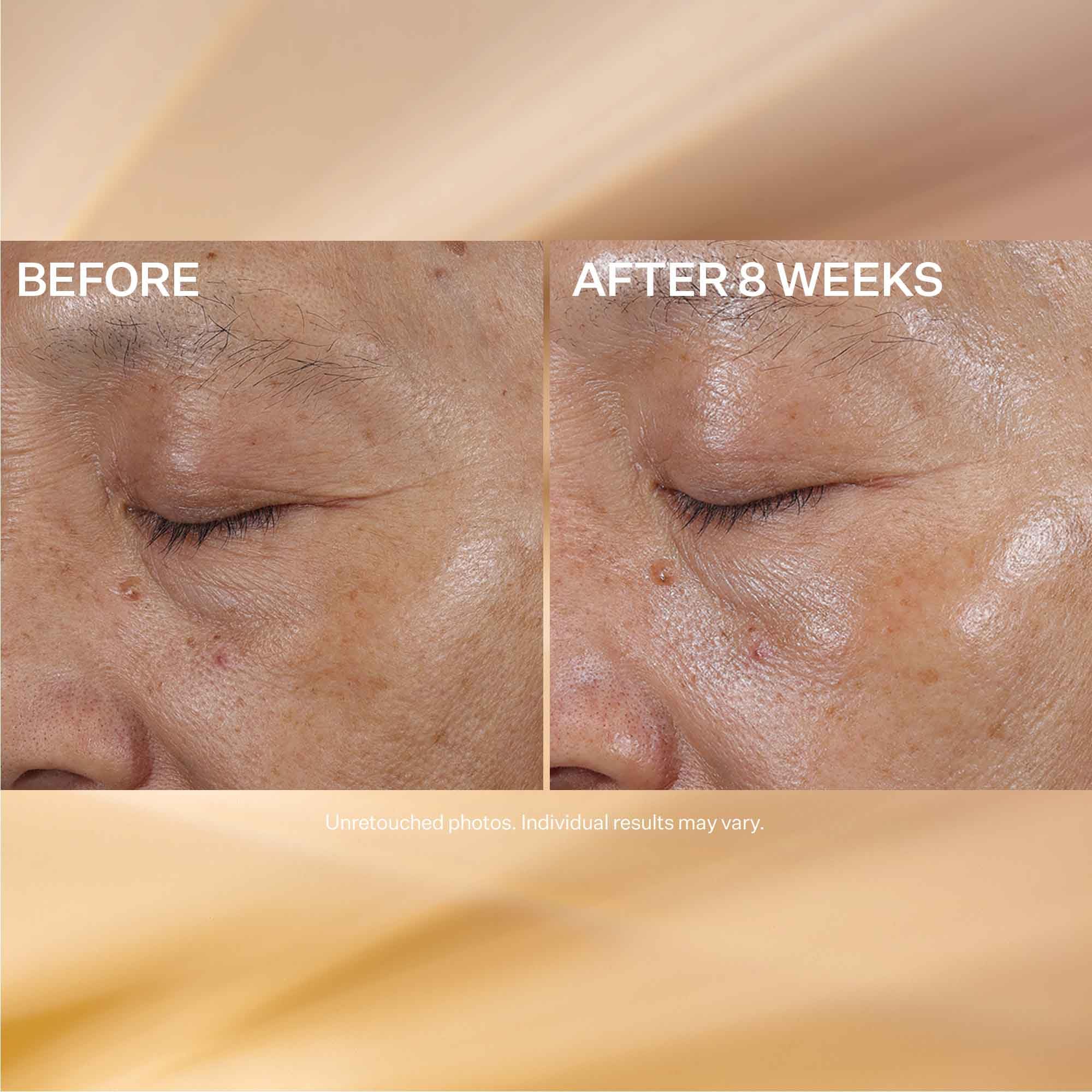 Foto 8 pulgar | Crema De Ojos Strivectin Super-c Con Vitamina C, Iluminadora Y Reafirmante - Venta Internacional.