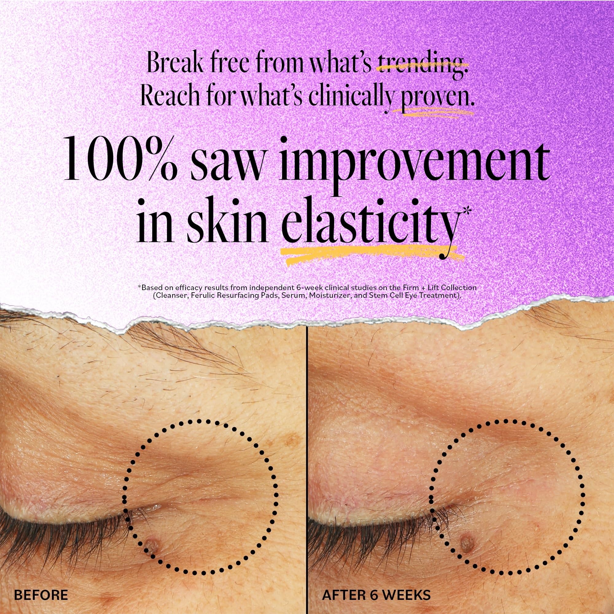 Foto 3 | Crema Reafirmante Derma E Stem Cell Lifting De 15 Ml Para Tratamiento De Ojos - Venta Internacional.