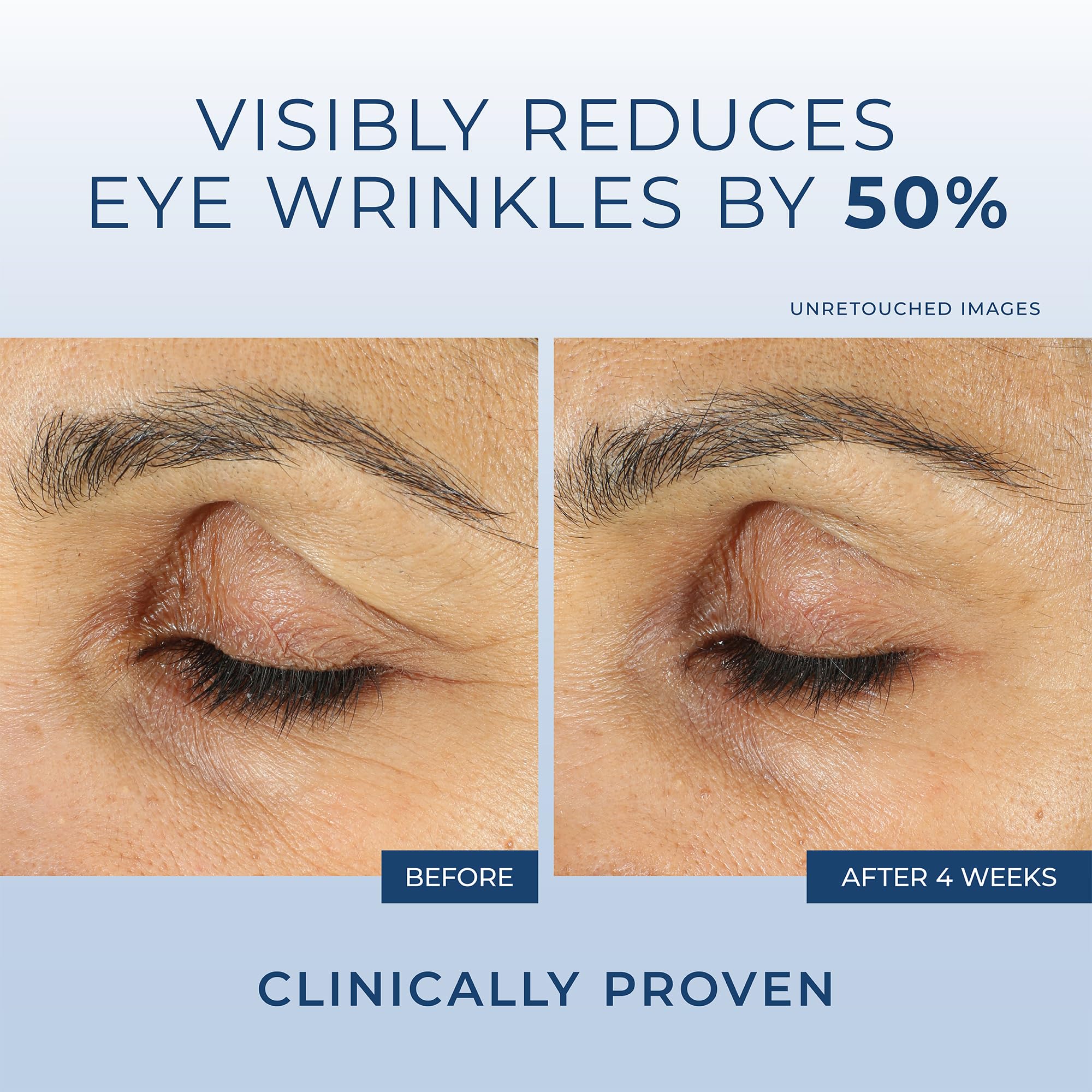 Foto 5 pulgar | Crema De Ojos Roc Retinol Correxion Para Ojeras E Hinchazón - Venta Internacional.