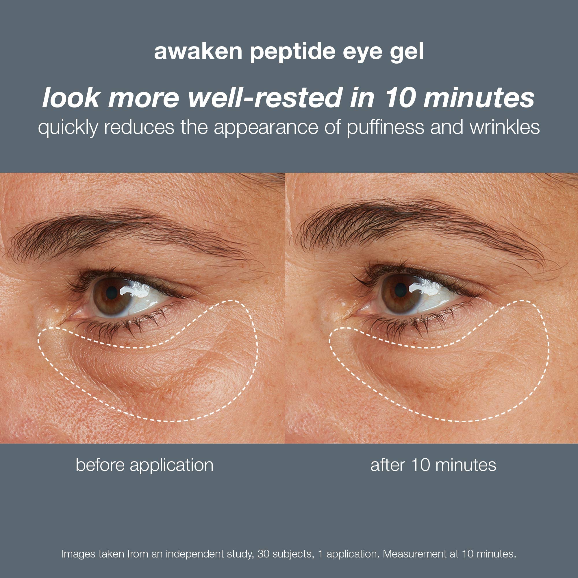 Foto 4 pulgar | El Gel Para Ojos Dermalogica Awaken Peptide Reduce La Hinchazón Y Las Arrugas - Venta Internacional.