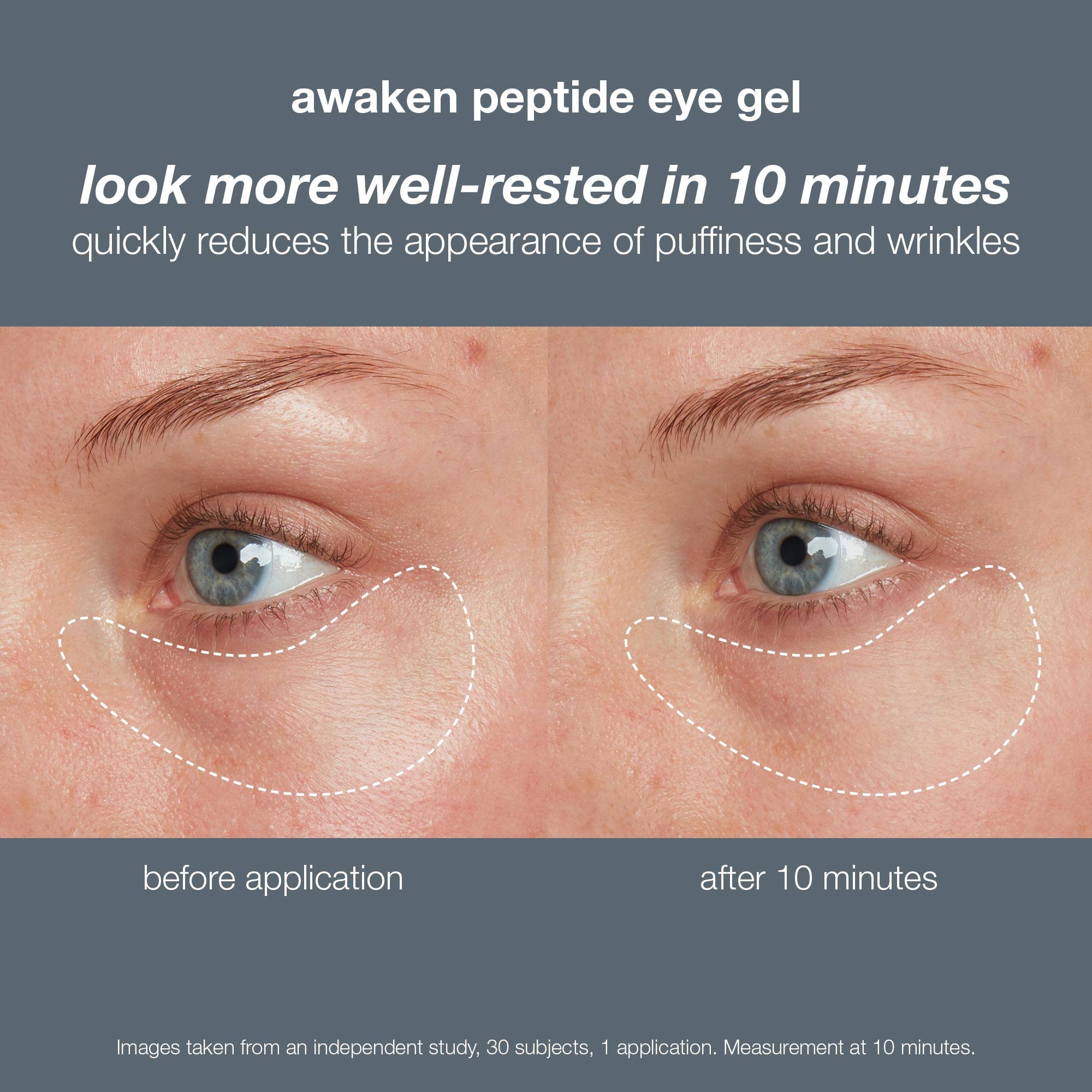 Foto 5 pulgar | El Gel Para Ojos Dermalogica Awaken Peptide Reduce La Hinchazón Y Las Arrugas - Venta Internacional.