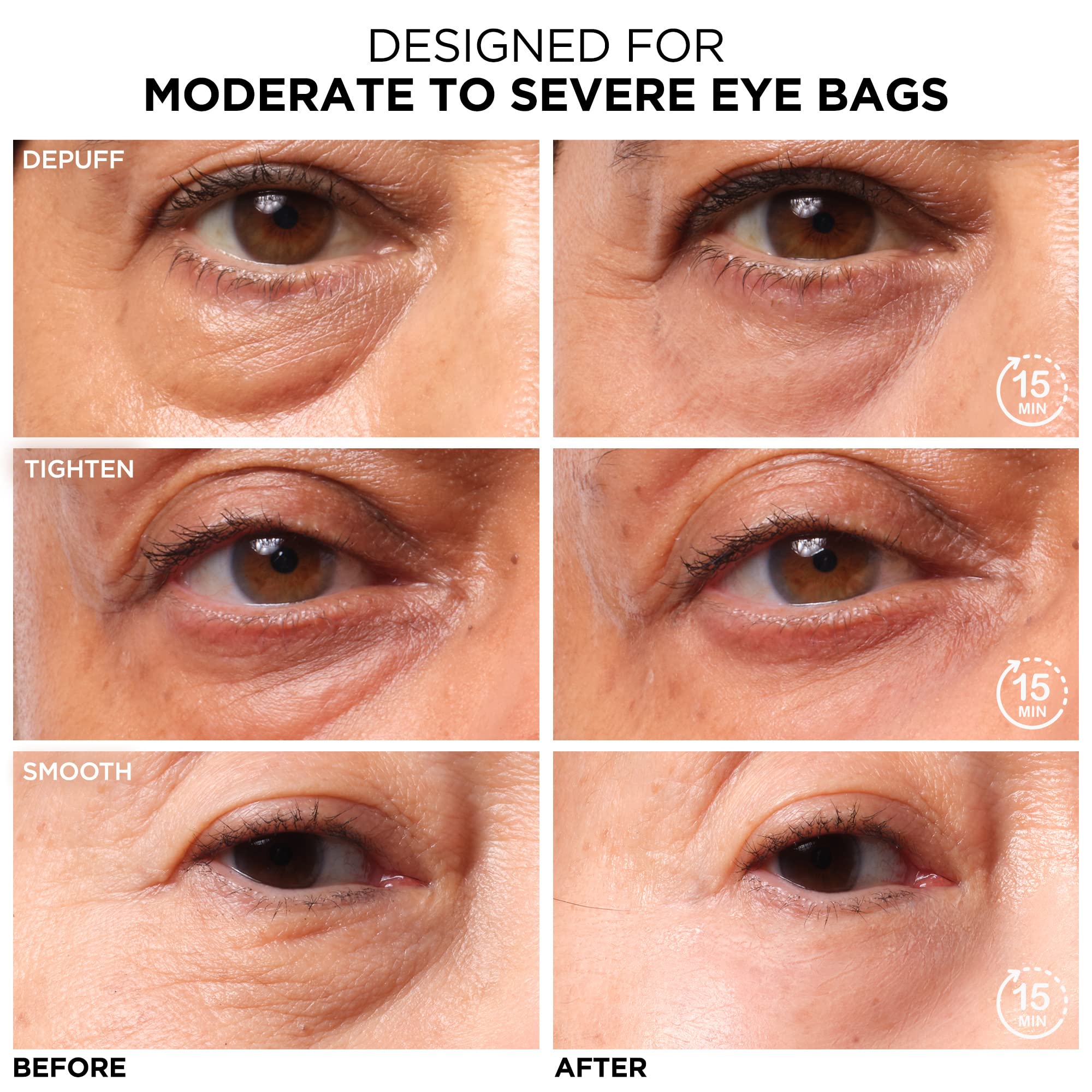 Foto 3 pulgar | Tratamiento Diurno De Bolsas Para Debajo De Los Ojos It Cosmetics Bye Bye - Venta Internacional.