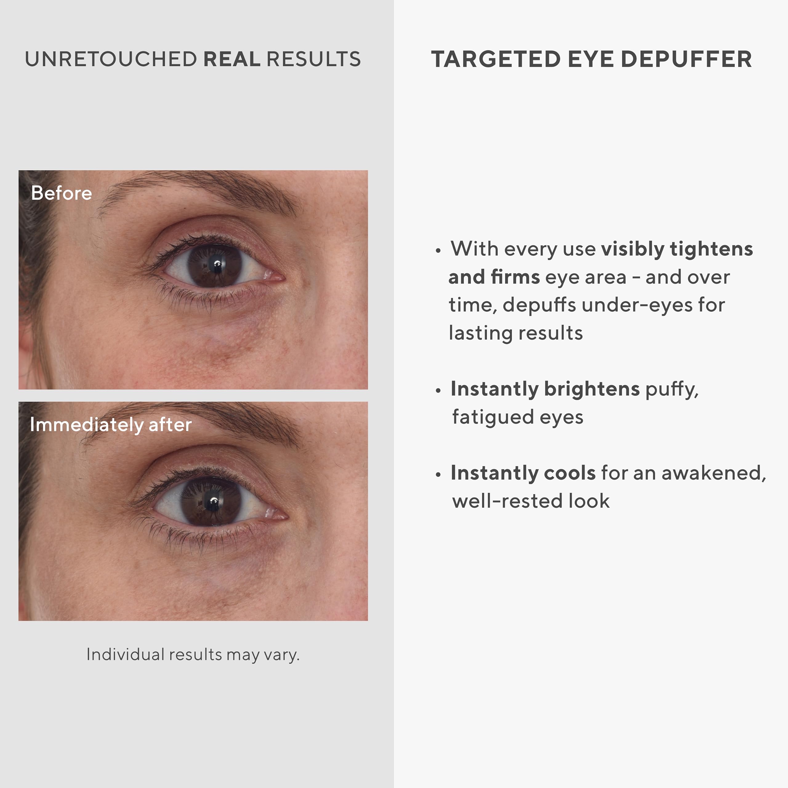 Foto 4 pulgar | Crema De Ojos Murad Targeted Eye Depuffer Antienvejecimiento 15 Ml - Venta Internacional.
