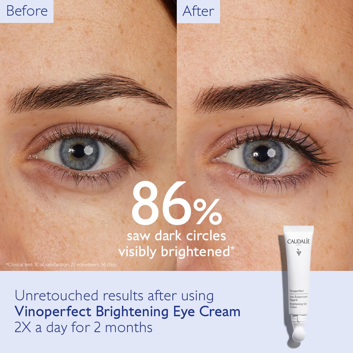 Foto 3 pulgar | Crema De Ojos Caudalie Vinoperfect Dark Circle Brightening - Venta Internacional.