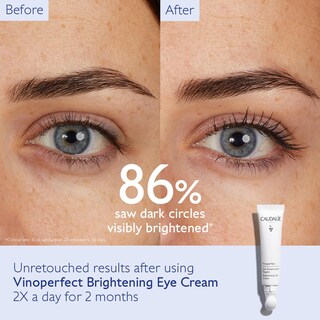 Foto 2 | Crema De Ojos Caudalie Vinoperfect Dark Circle Brightening - Venta Internacional.