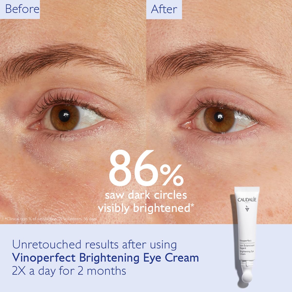 Foto 4 pulgar | Crema De Ojos Caudalie Vinoperfect Dark Circle Brightening - Venta Internacional.