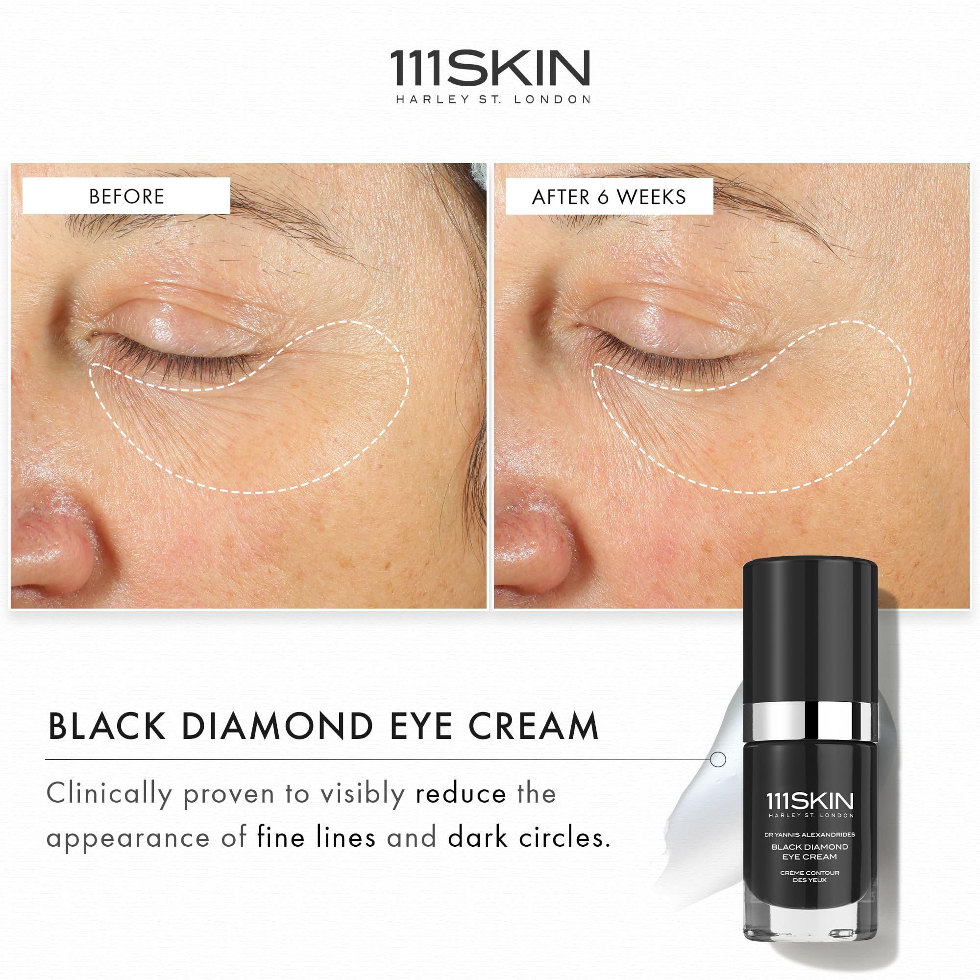 Foto 3 pulgar | Crema De Ojos 111skin Black Diamond Con Retinoide Granactivo 15 Ml - Venta Internacional.