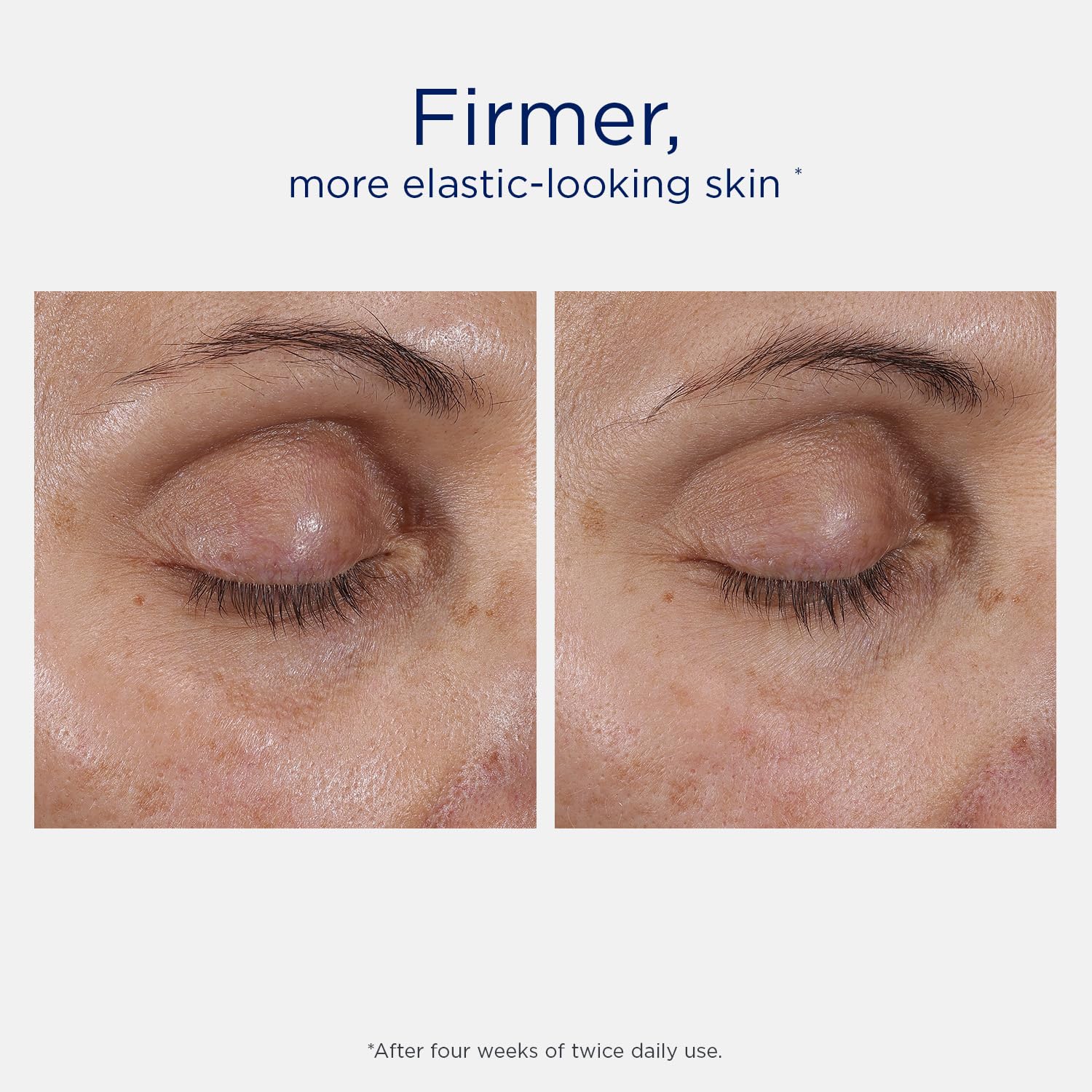 Foto 5 pulgar | Terapia Ocular Neostrata Skin Active Intensive 15 Ml - Venta Internacional.