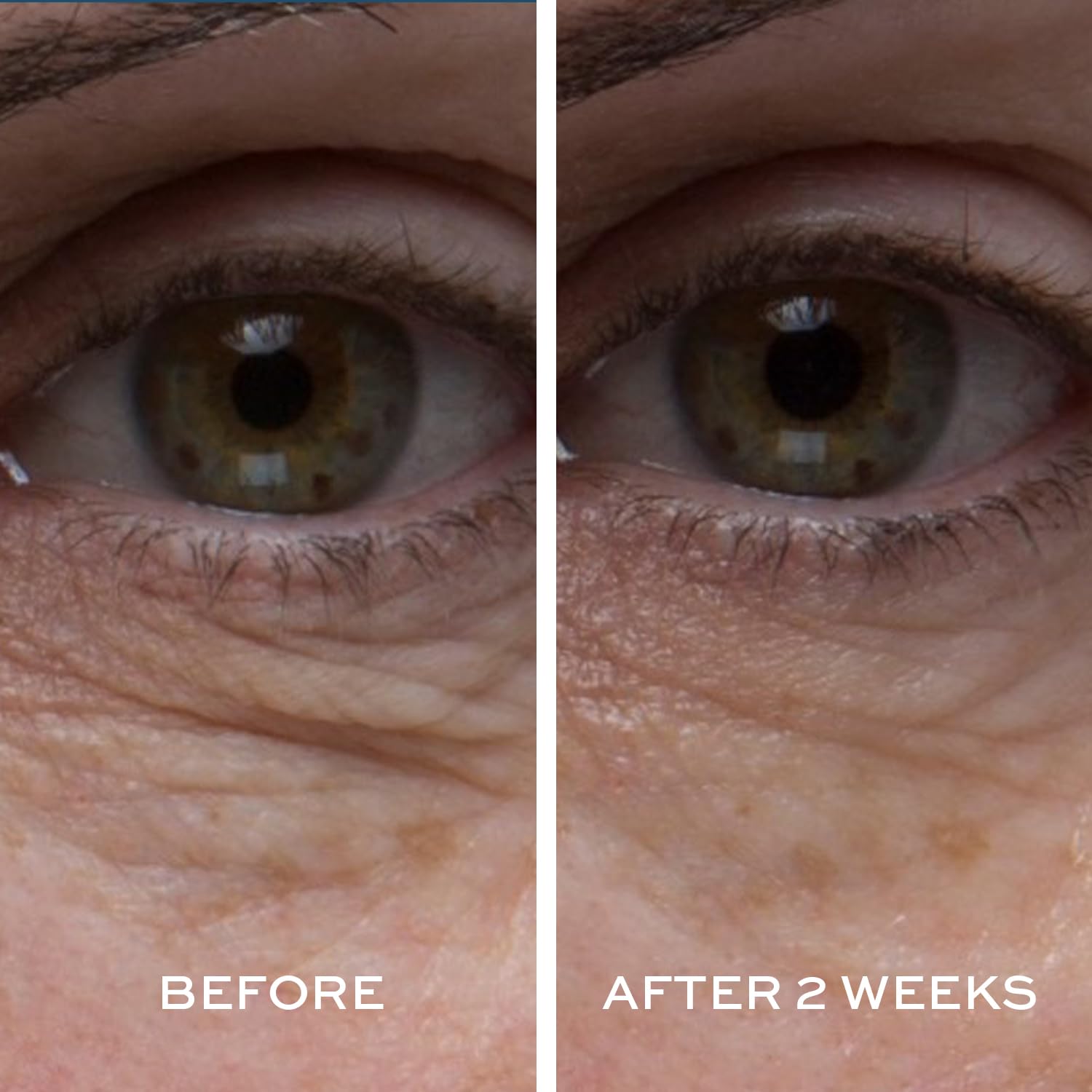 Foto 5 pulgar | Crema De Recuperación Ocular Elemis Peptide4 Reviving 15 Ml - Venta Internacional.