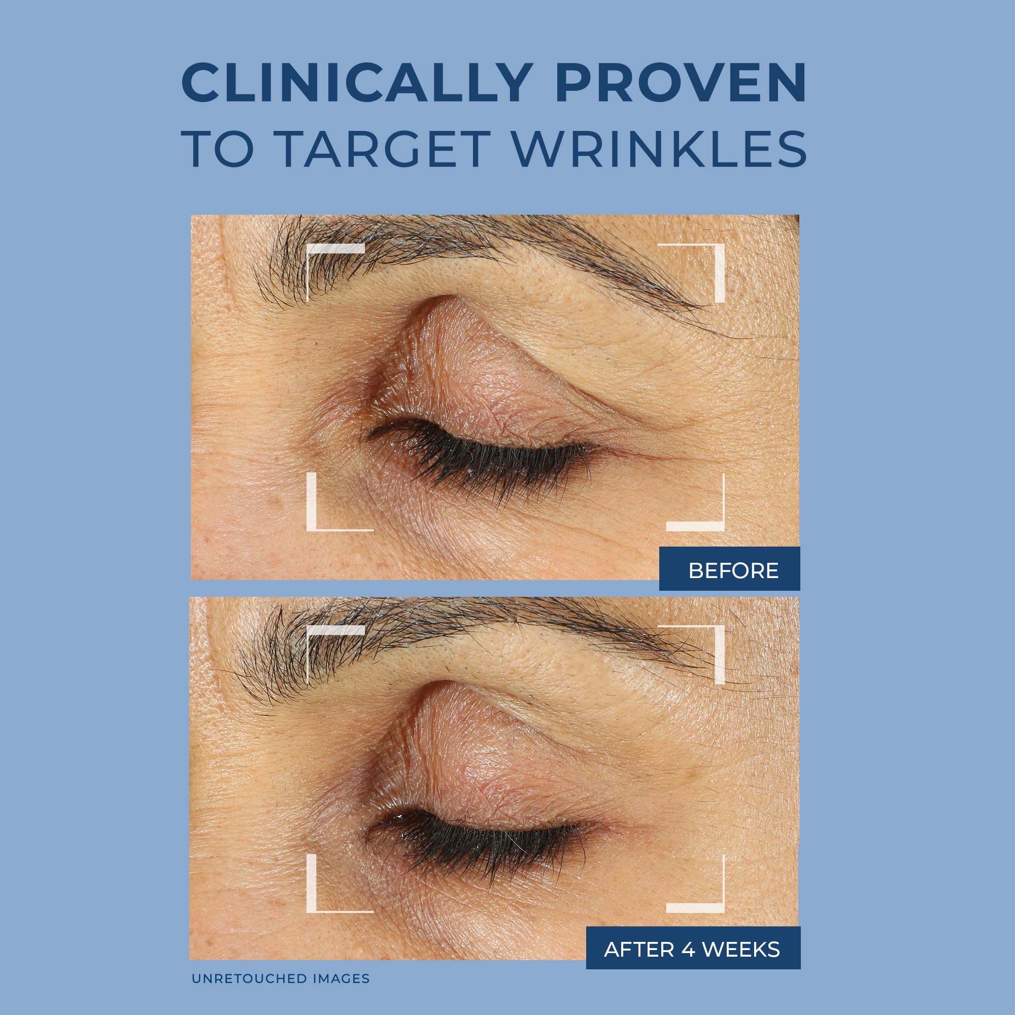 Foto 5 pulgar | Crema De Ojos Roc Retinol Correxion Para Ojeras E Hinchazón, 15 Ml - Venta Internacional.