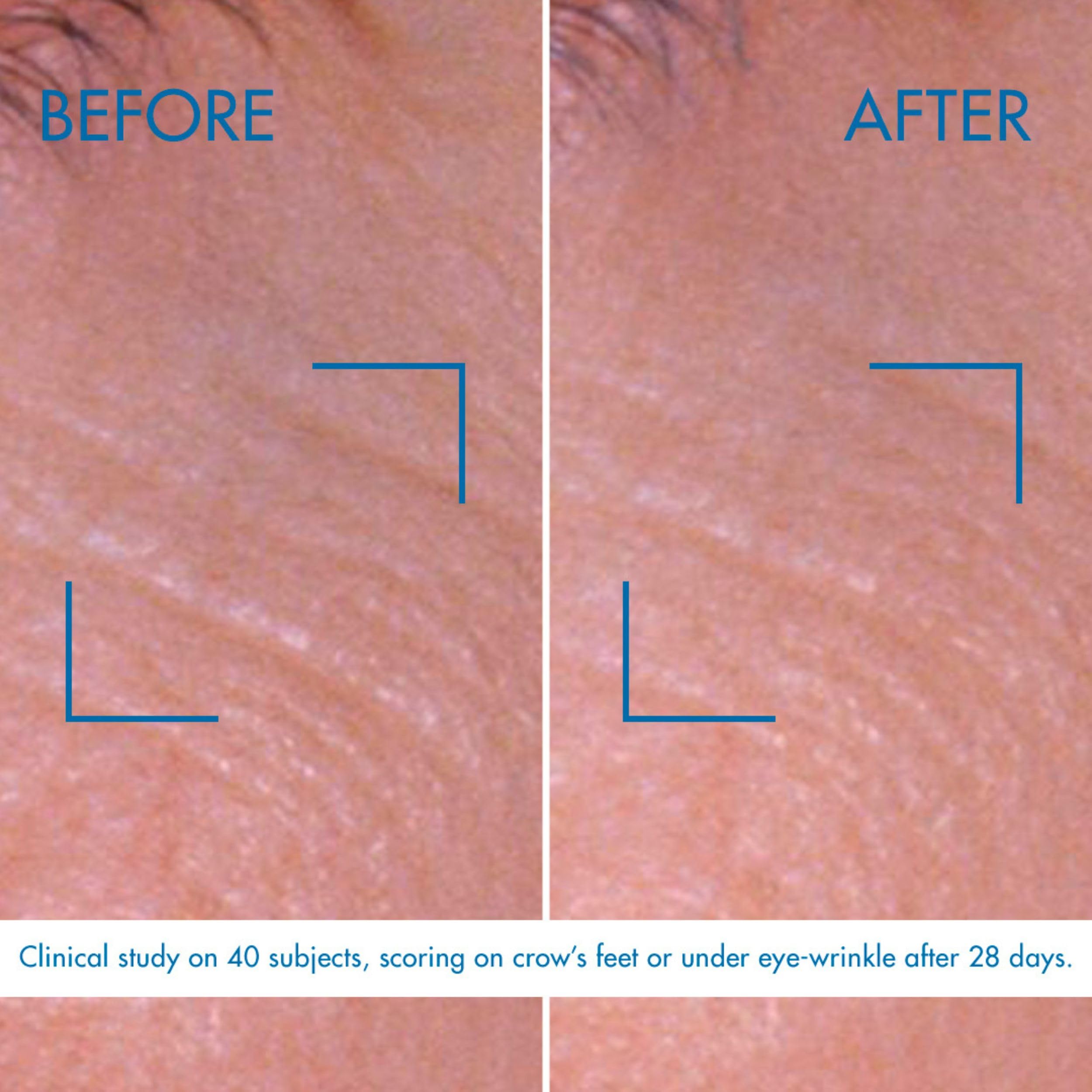 Foto 5 pulgar | Crema De Ojos Biotherm Blue Pro-retinol Suavizante De Arrugas 15 Ml - Venta Internacional.
