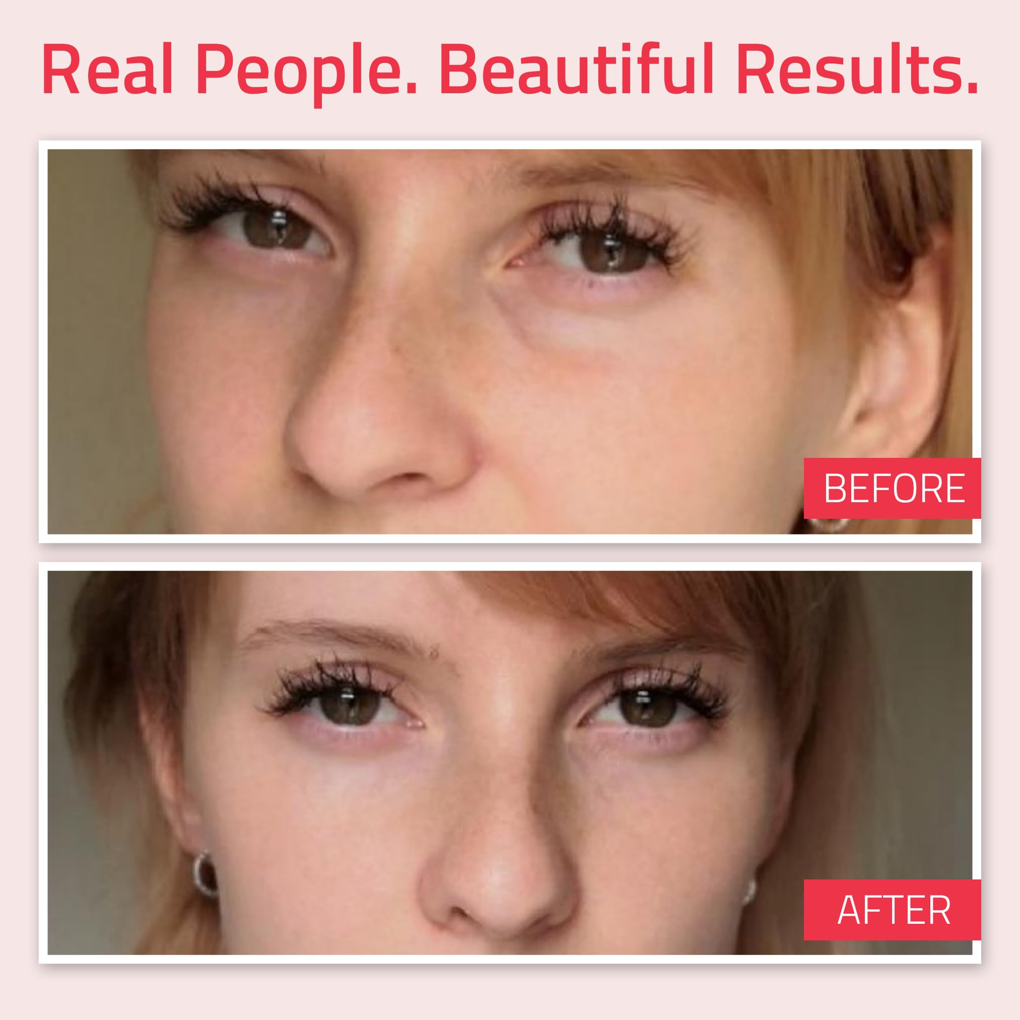 Foto 4 | Crema De Ojos Yeouth Retinol Con Ácido Hialurónico 30 Ml Para Ojeras - Venta Internacional.