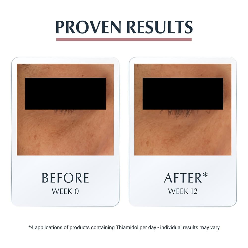 Foto 6 pulgar | Crema Para Ojos Eucerin Face Antipigment Dark Circle 15 Ml - Venta Internacional.