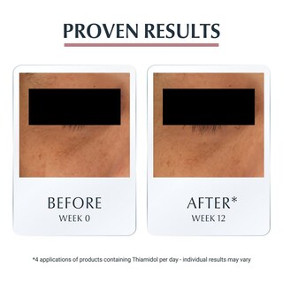 Foto 5 | Crema Para Ojos Eucerin Face Antipigment Dark Circle 15 Ml - Venta Internacional.