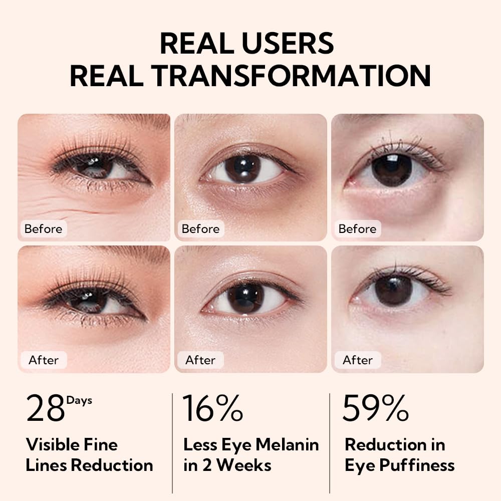 Foto 6 pulgar | Crema De Ojos Lanbena Vitamina C Para Arrugas Y Ojeras 30 Ml - Venta Internacional.