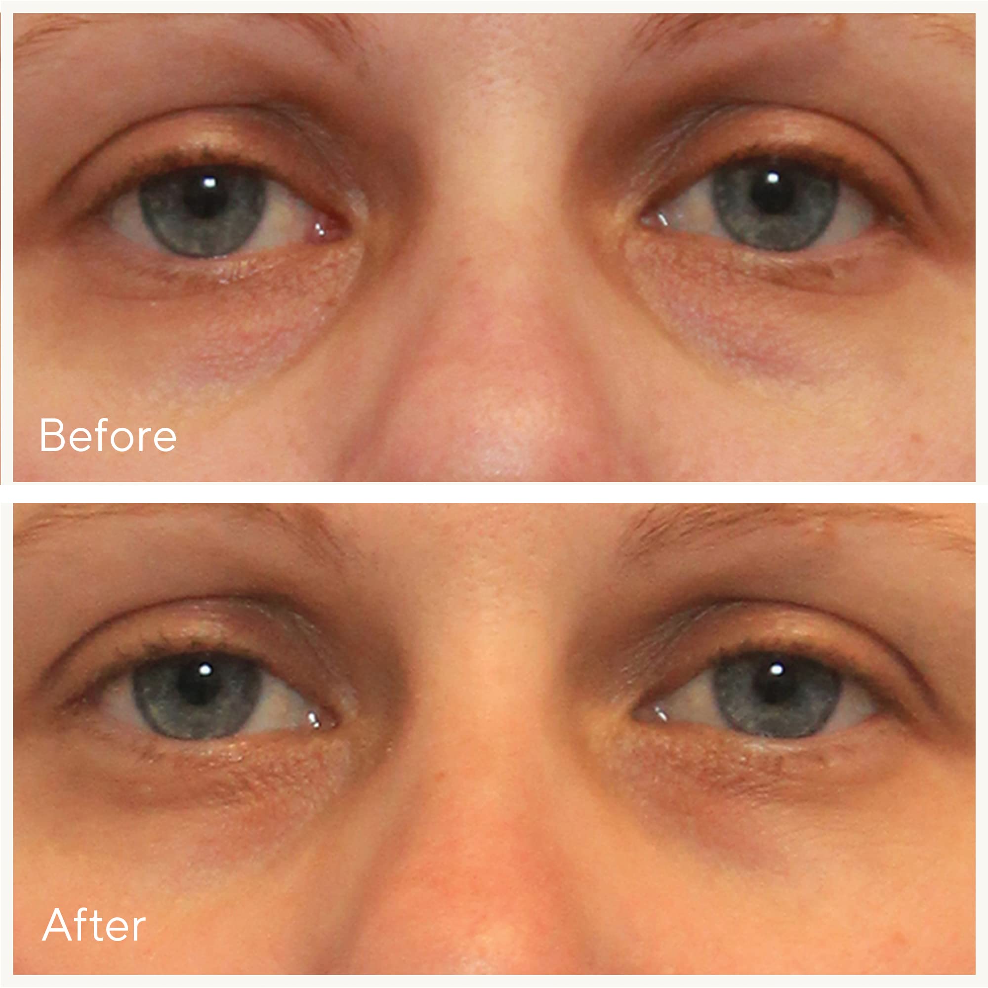 Foto 3 pulgar | Sérum Corrector De Ojeras Murad Vita-c Eyes 15 Ml - Venta Internacional.