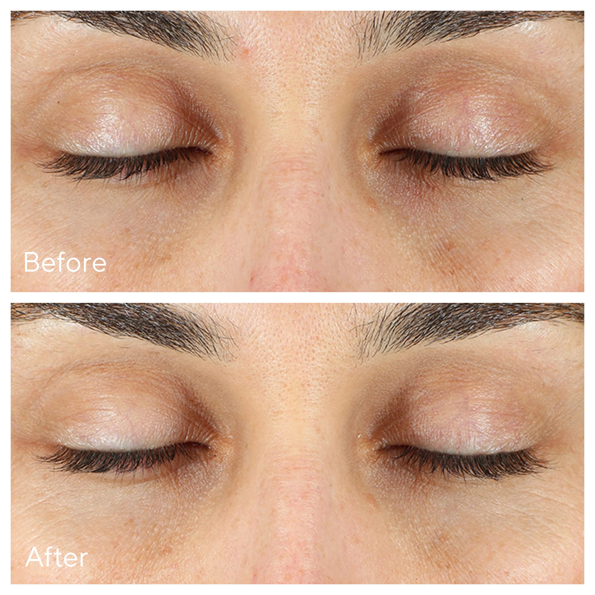 Foto 4 pulgar | Sérum Corrector De Ojeras Murad Vita-c Eyes 15 Ml - Venta Internacional.