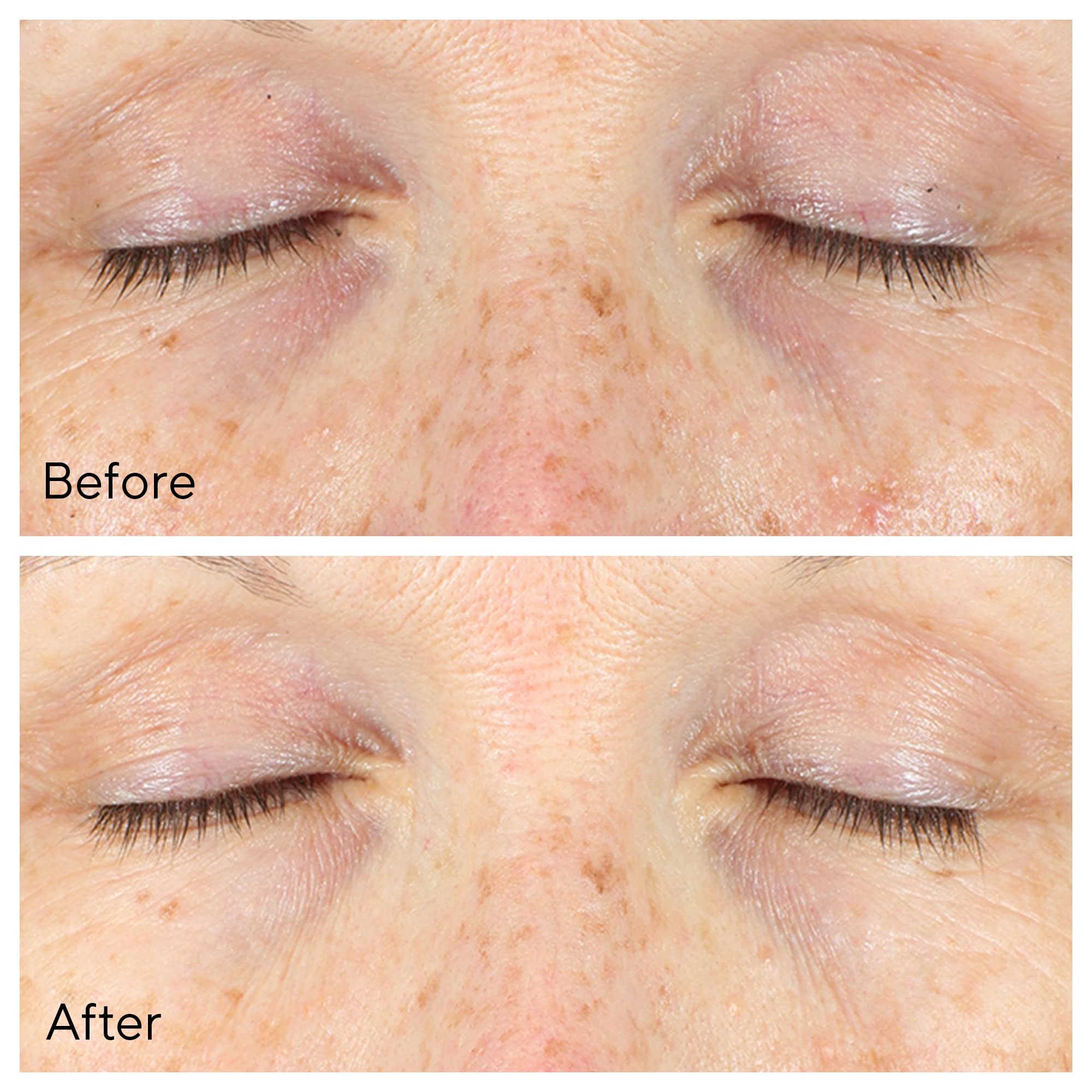 Foto 5 pulgar | Sérum Corrector De Ojeras Murad Vita-c Eyes 15 Ml - Venta Internacional.