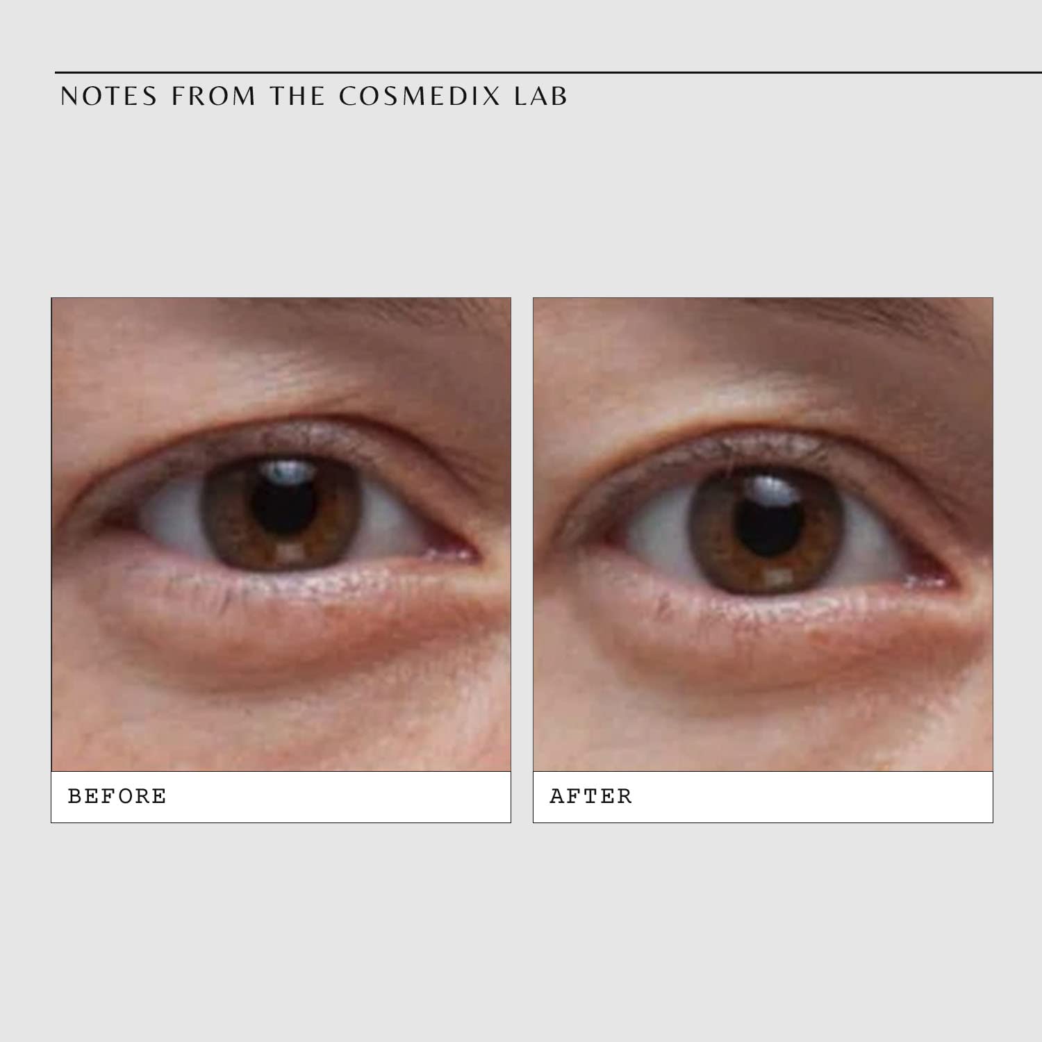 Foto 6 pulgar | Sérum Para Ojos Cosmedix Opti Crystal, Reafirmante Y Reafirmante, Antienvejecimiento - Venta Internacional.