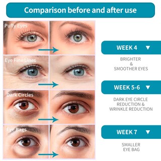 Foto 2 | Crema De Ojos Lanbena Para Arrugas, Antienvejecimiento Con Ácido Hialurónico - Venta Internacional.