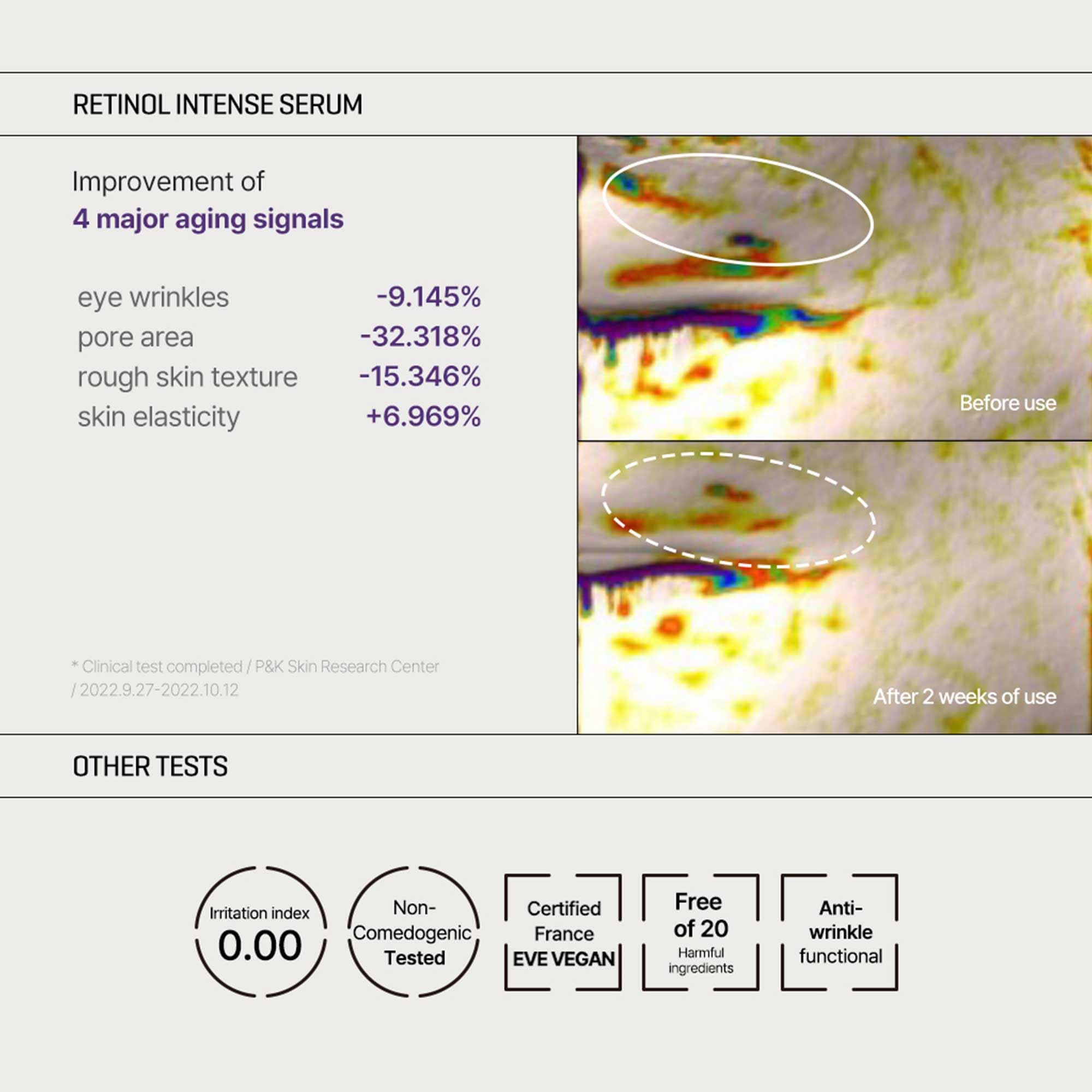 Foto 5 | Trial Kit Some By Mi Sérum Intenso Con Retinol De 10 Ml Y Crema Para Ojos - Venta Internacional.