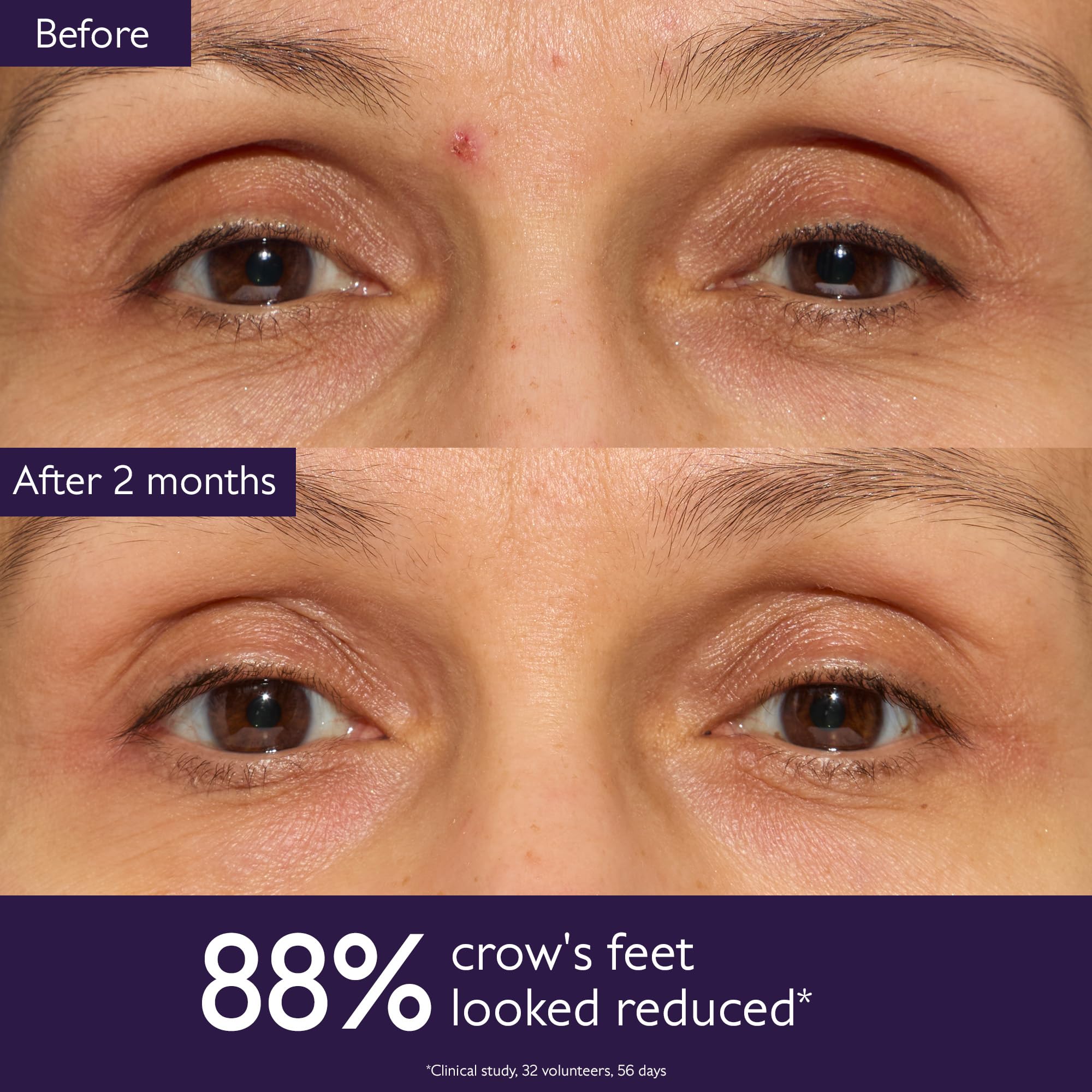 Foto 5 pulgar | Crema De Ojos Caudalie Premier Cru Antiedad 15ml - Venta Internacional.