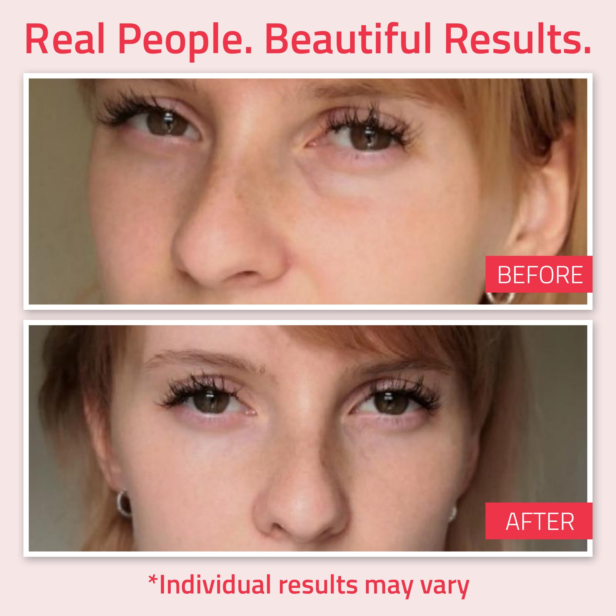 Foto 3 | Crema De Ojos Yeouth Retinol, Reafirmante Antienvejecimiento, 15 Ml, Con Ácido Hialurónico - Venta Internacional.