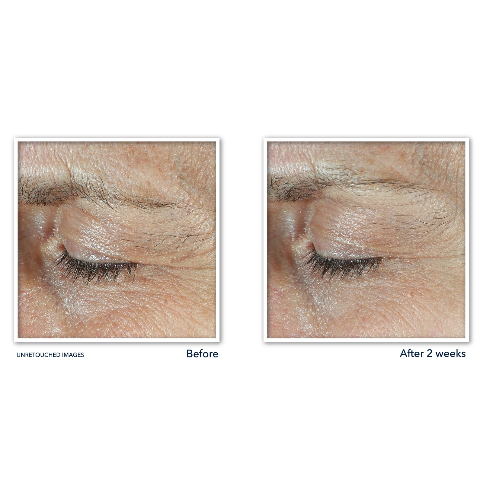 Foto 6 | Crema Para Ojos Roc Derm Correxion Dual Con Retinol Y Péptidos  20 Ml - Venta Internacional.