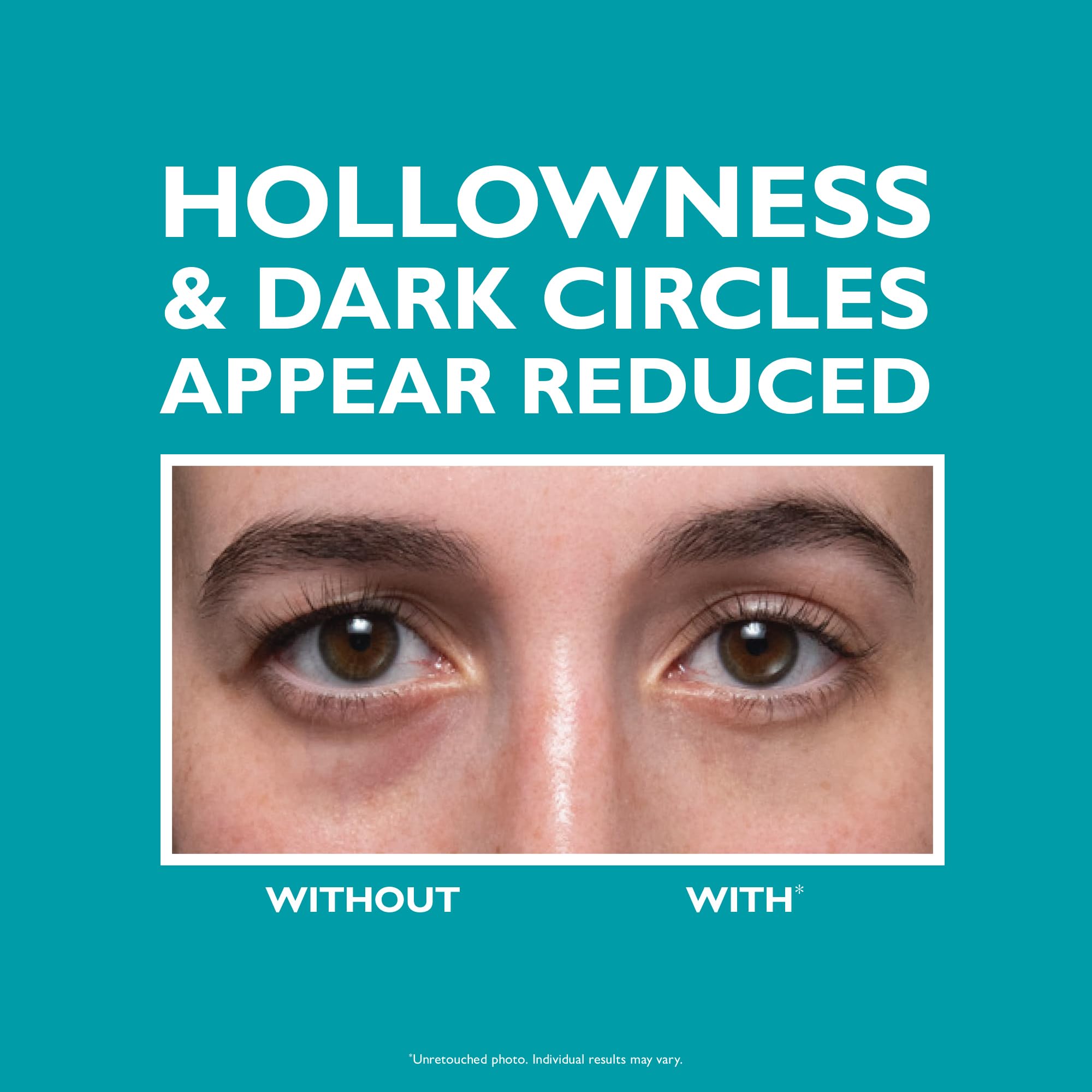 Foto 4 pulgar | Crema Para Ojos Peter Thomas Roth Peptide Skinjection Fill + Fix - Venta Internacional.