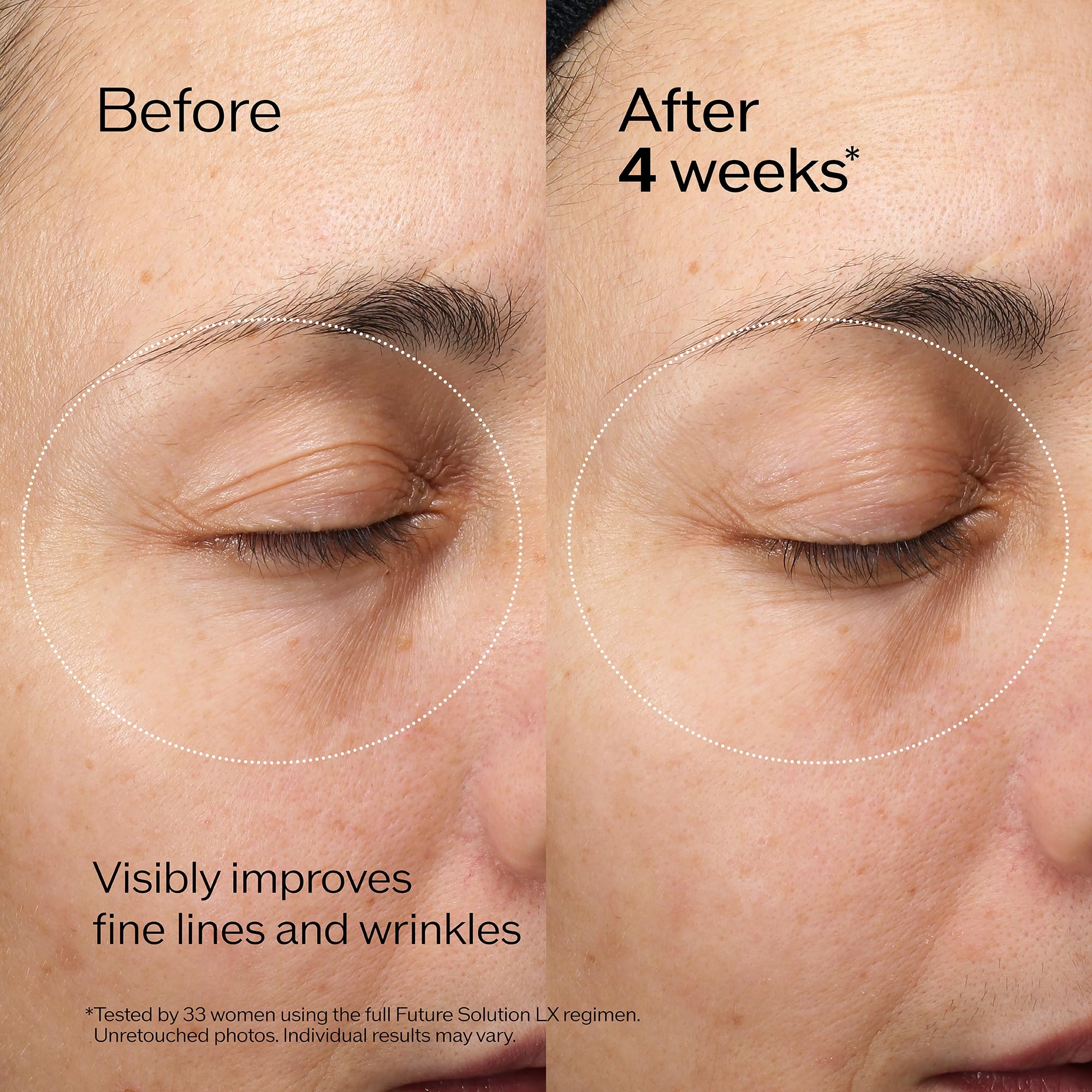 Foto 5 pulgar | Crema De Recambio Shiseido Future Solution Lx Eye Lip 17 Ml - Venta Internacional.