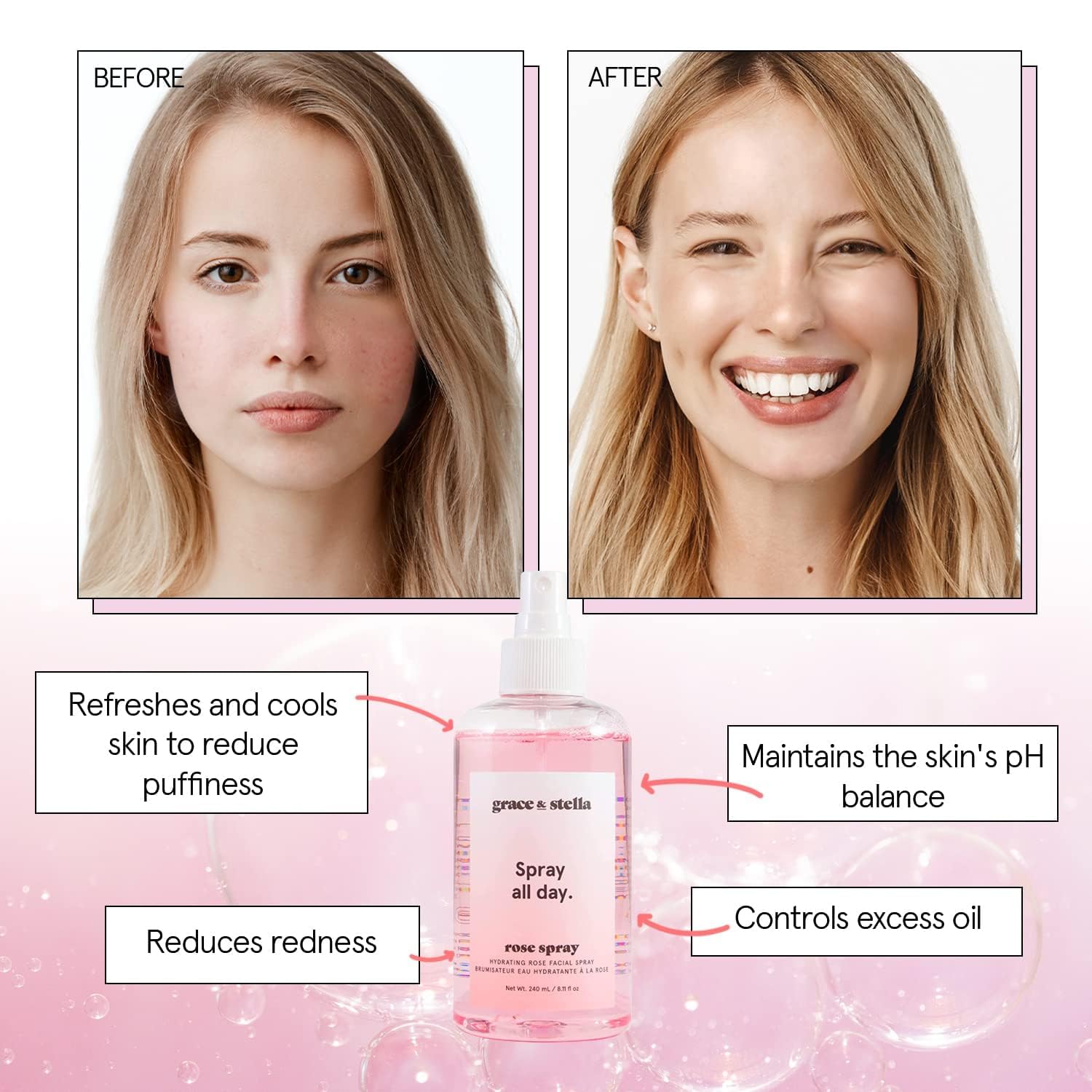 Foto 4 pulgar | Spray Facial Grace & Stella, Galardonado Con El Premio, Agua De Rosas, 240 Ml - Venta Internacional.