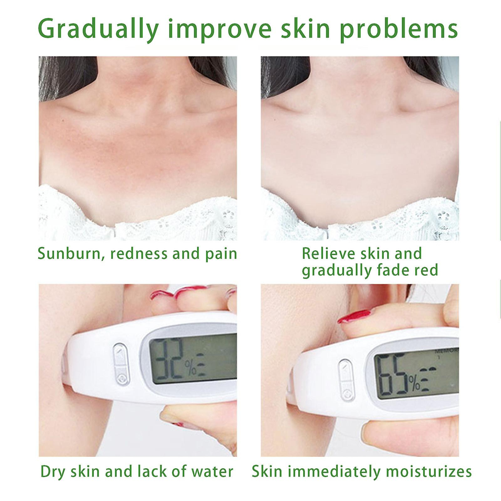 Foto 5 pulgar | Loción Para Después Del Sol  Gel De Aloe Vera Nutritivo Para Después Del Sol  80 Ml (20 Unidades) - Venta Internacion