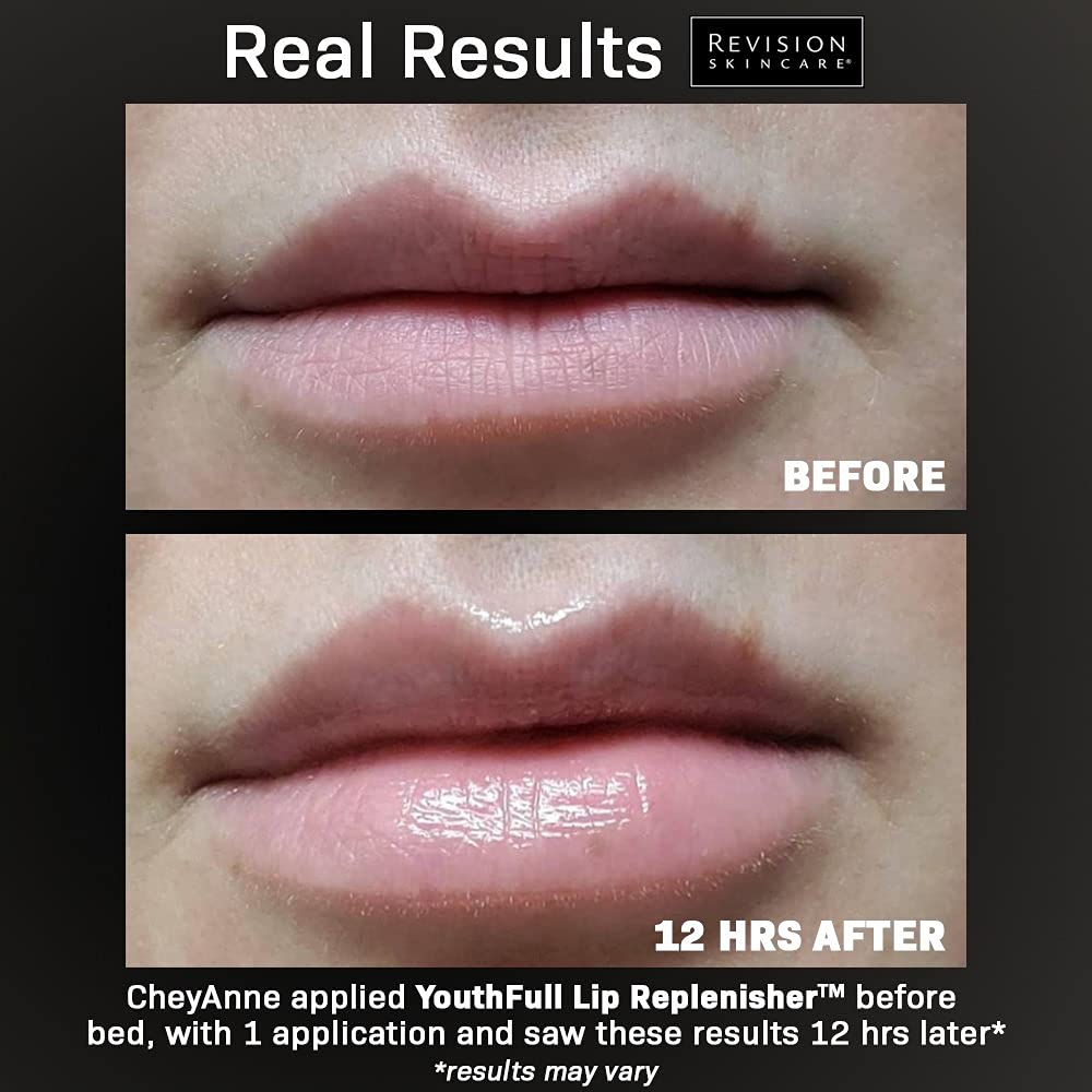 Foto 4 pulgar | Venta Internacional- Restaura el Volumen Juvenil de los Labios con SkinCare Hialu