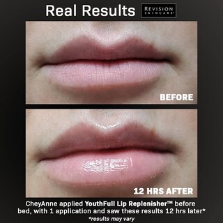 Foto 3 | Venta Internacional- Restaura el Volumen Juvenil de los Labios con SkinCare Hialu