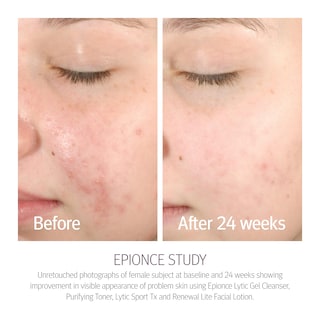 Foto 6 | Limpiador Facial Purificante Y Desmaquillante Toner Epionce - Venta Internacional.