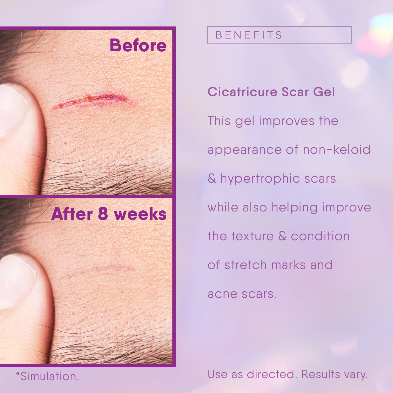 Foto 5 | Gel Para Cicatrices Cicatricure Para Rostro Y Cuerpo, 30 Ml (1 Oz), Paquete De 2 - Venta Internacional.