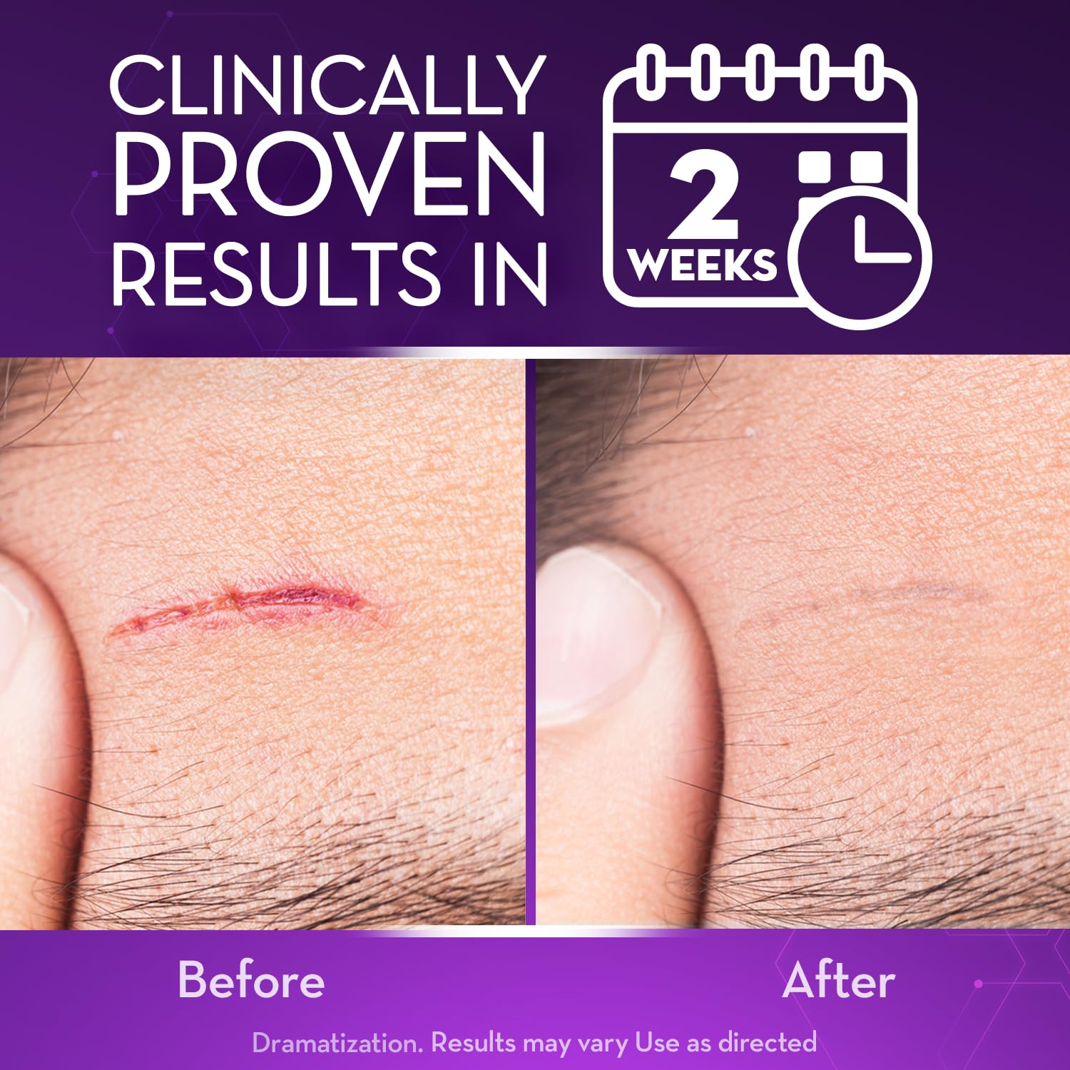 Foto 3 | Gel Para Cicatrices Cicatricure Advanced Para Rostro Y Cuerpo, 28 Ml, Paquete De 3 - Venta Internacional.
