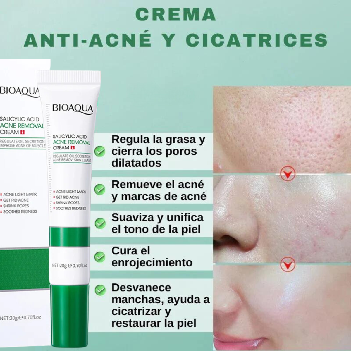Foto 6 pulgar | Crema Limpieza Facial Ácido Salicílico Anti Acné Cicatriz