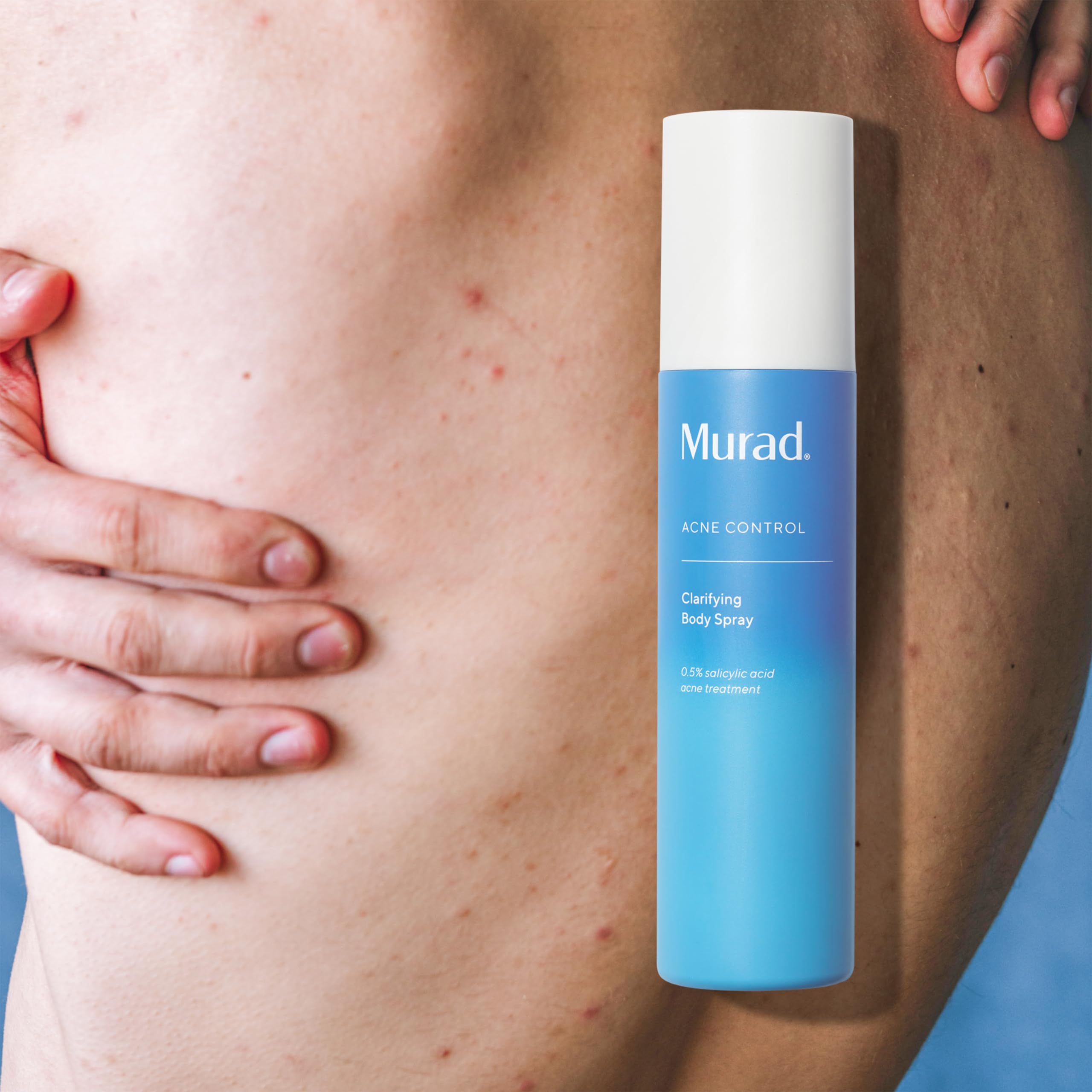 Foto 5 | Spray Corporal Murad Clarifying Con Ácido Salicílico 180 Ml Para El Acné - Venta Internacional.