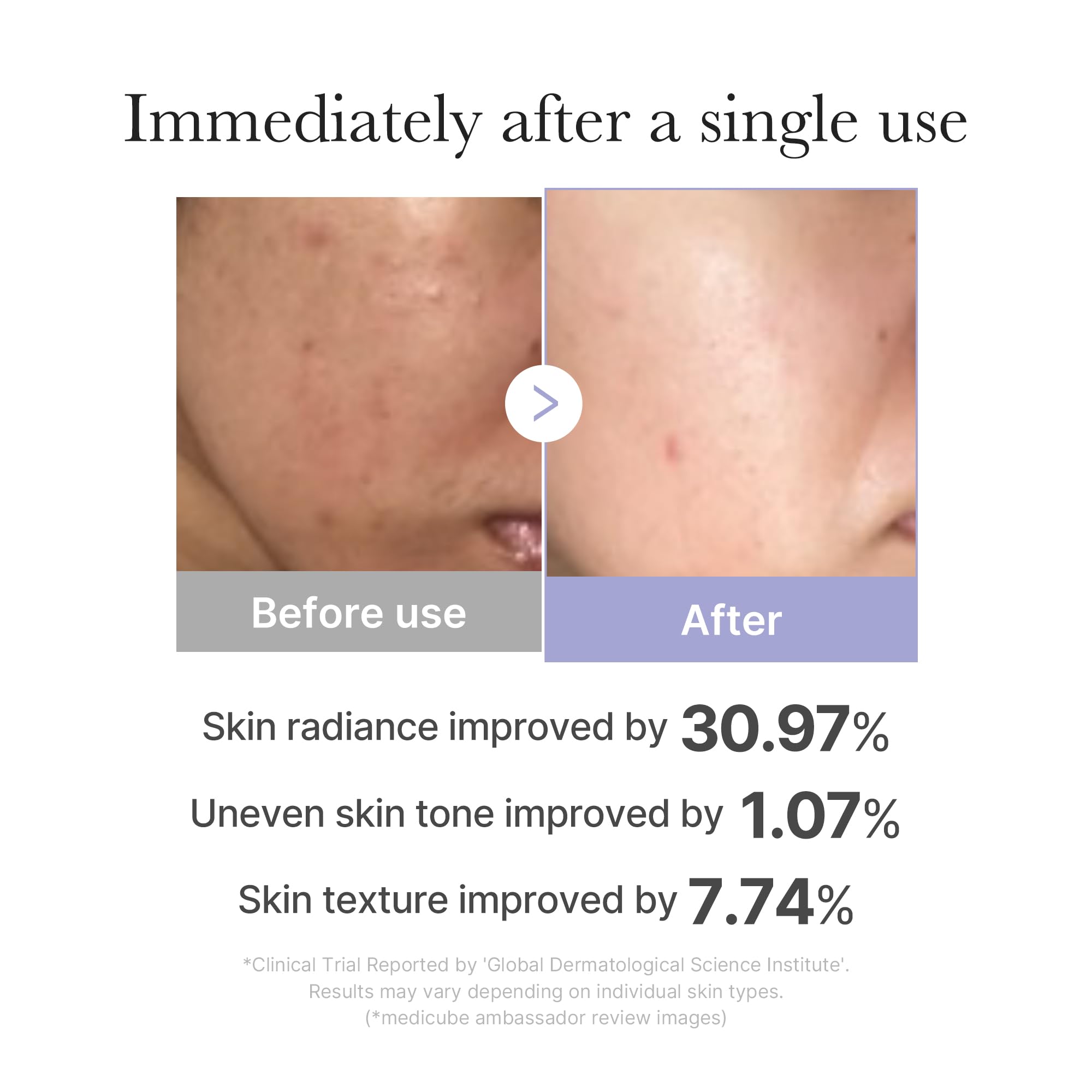 Foto 3 | Herramienta Para El Cuidado De La Piel Facial Medicube Mini Booster Pro Pink - Venta Internacional.