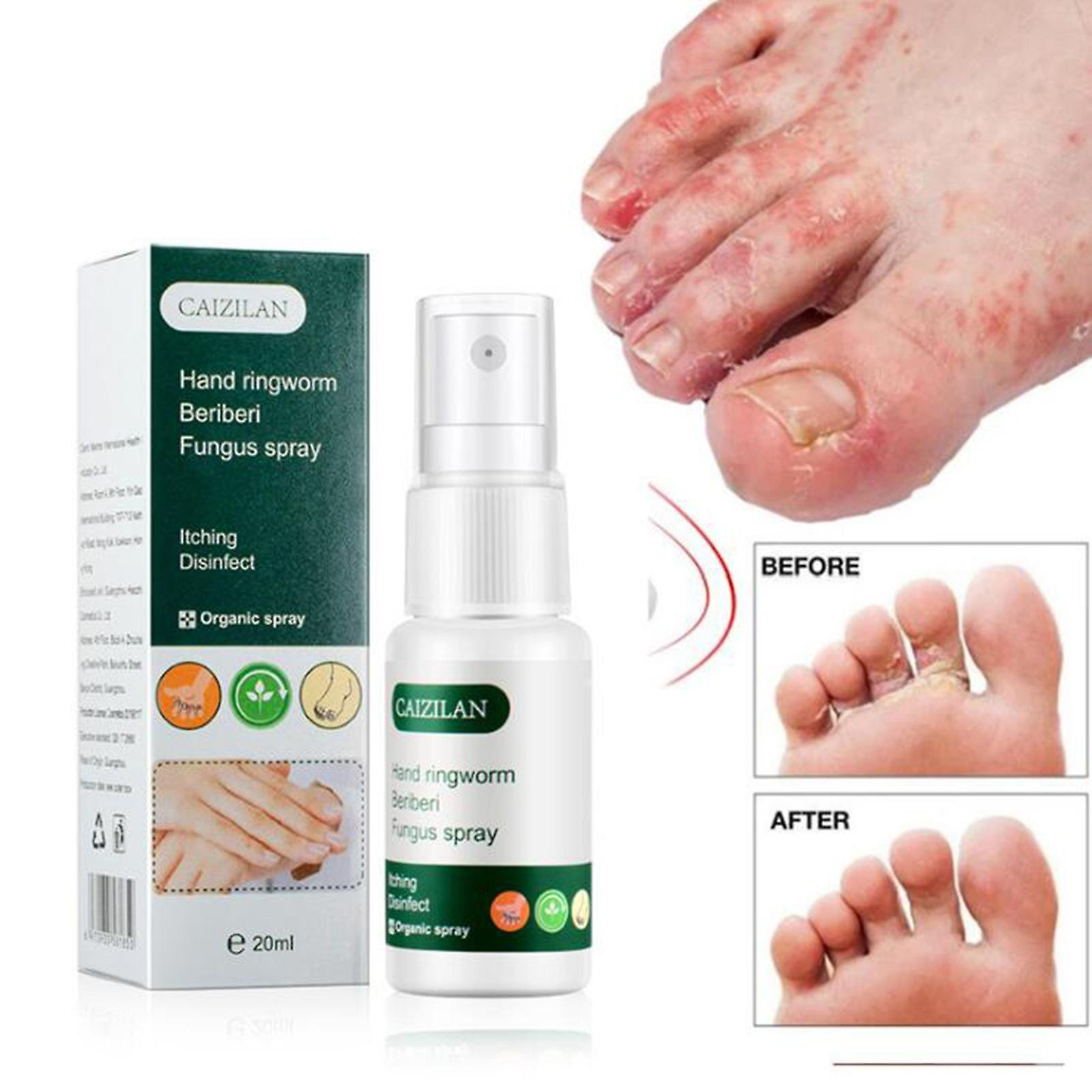 Foto 3 pulgar | Spray Caizilan Para Manos Y Pies  20 Ml - Venta Internacional.