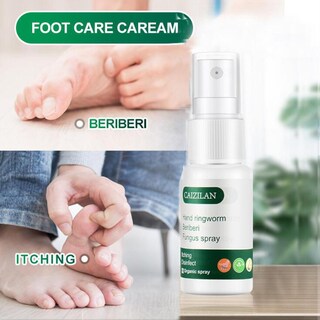 Foto 5 | Spray Caizilan Para Manos Y Pies 20 Ml - Venta Internacional.