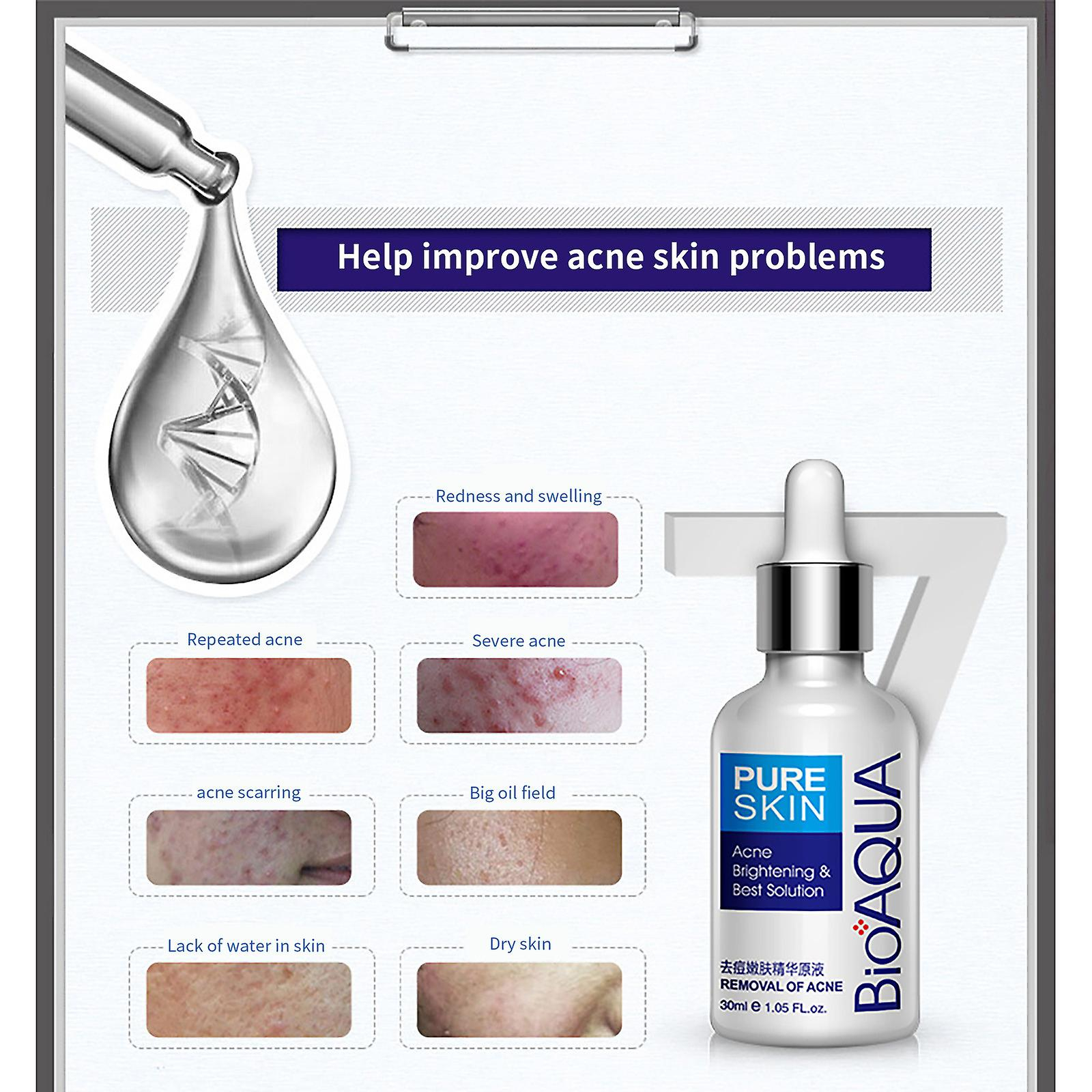 Foto 3 | Crema Facial Essence Para El Acné  30 Ml  2 Unidades Huoguo - Venta Internacional.