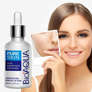 Foto 2 | Crema Hidratante Para El Acné Huoguo Para Rostro 30 G - Venta Internacional.