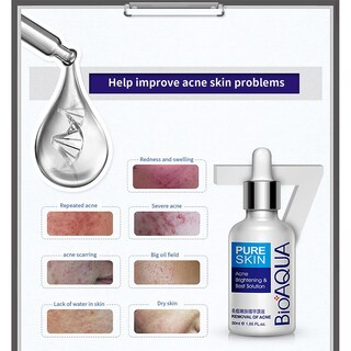 Foto 3 | Crema Hidratante Para El Acné Huoguo Para Rostro 30 G - Venta Internacional.